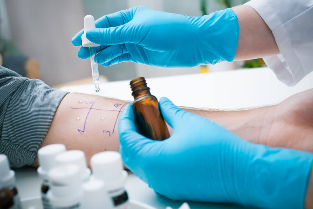 food allergy testing near me