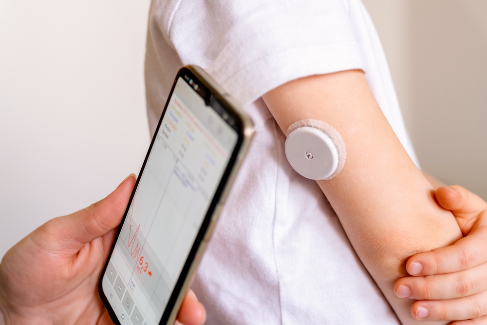 CGM system Of Continuous Monitoring Of Glucose On Child's Arm